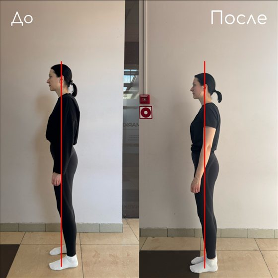 Осанка клиентки до и после тренировок, вид сбоку